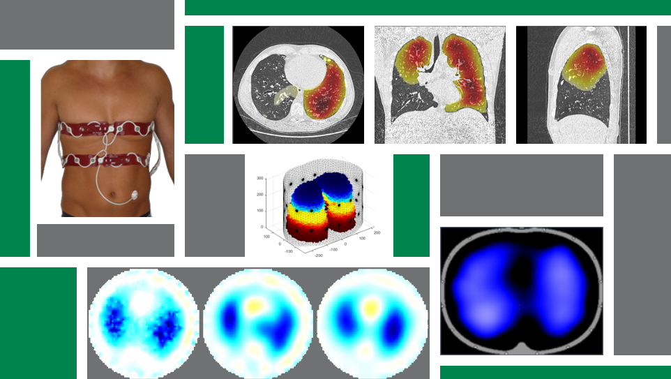 ITeM - Electrical Impedance Tomography (EIT)